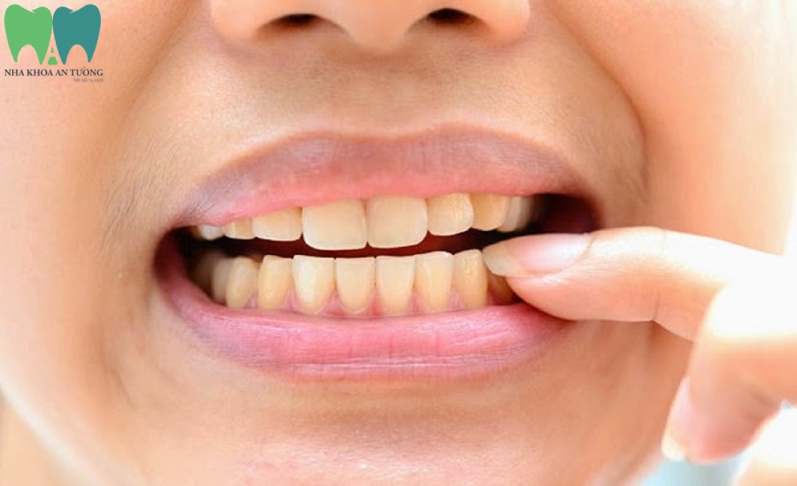 Cách chữa viêm nha chu răng tại nhà